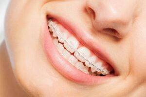 Orthodontics